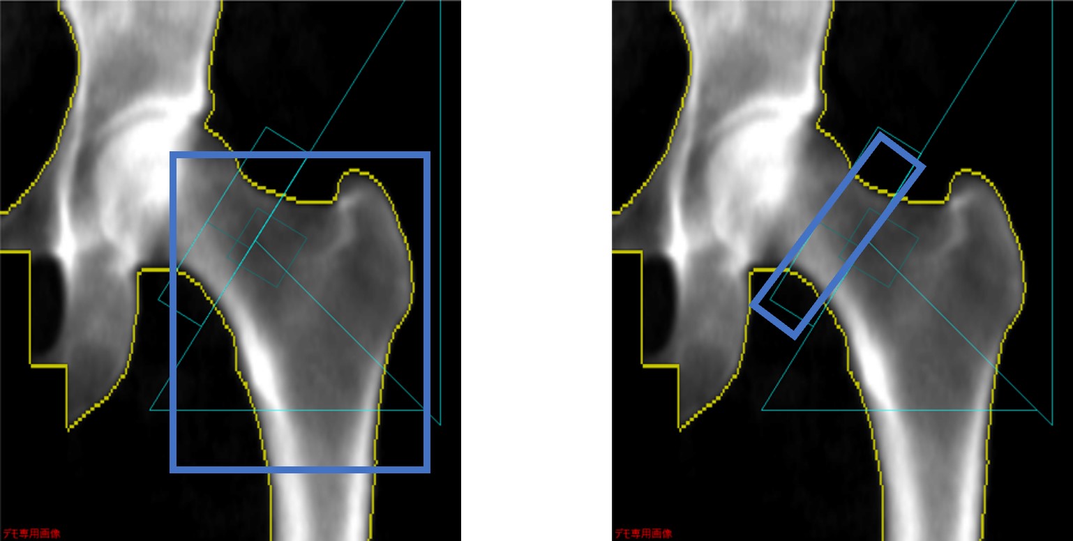 Clinical Tips_yokohamashitobu10.jpg